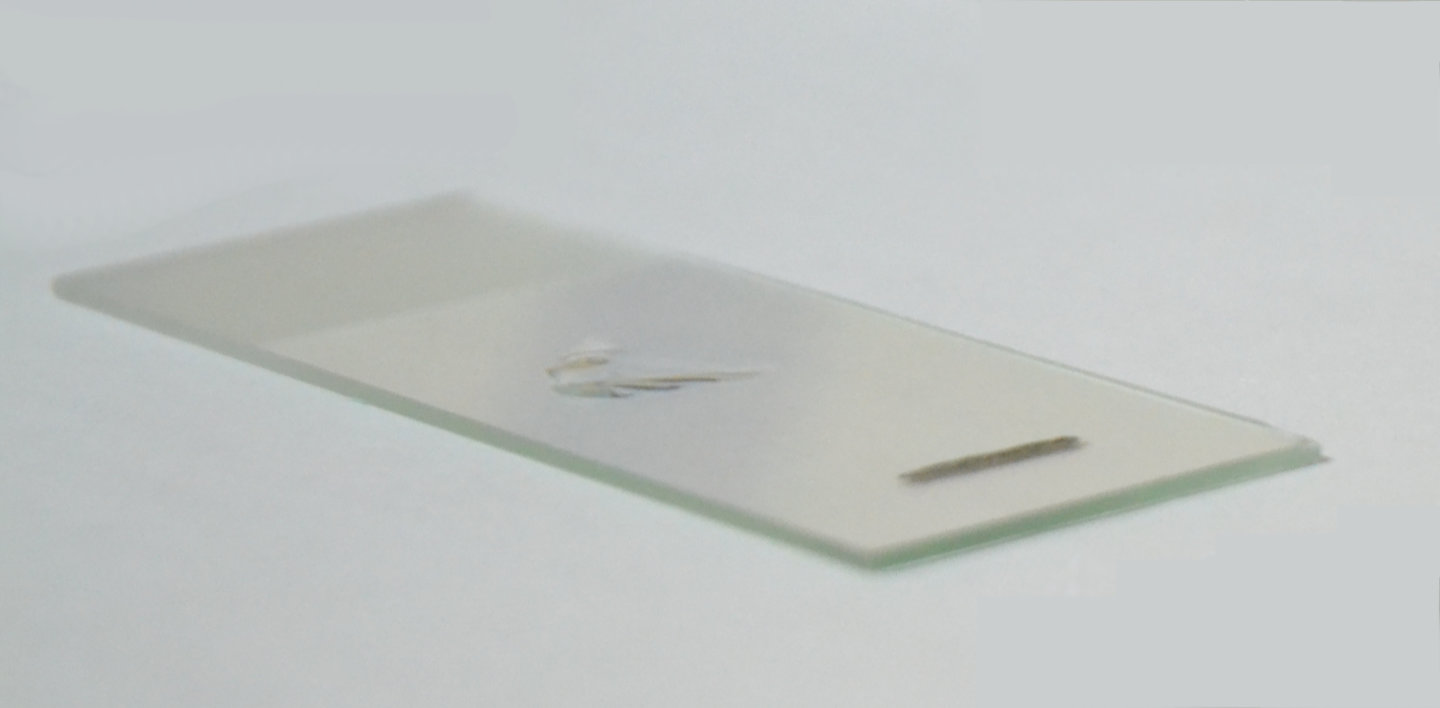 Диагностика Урологических Заболеваний | Частный Уролог